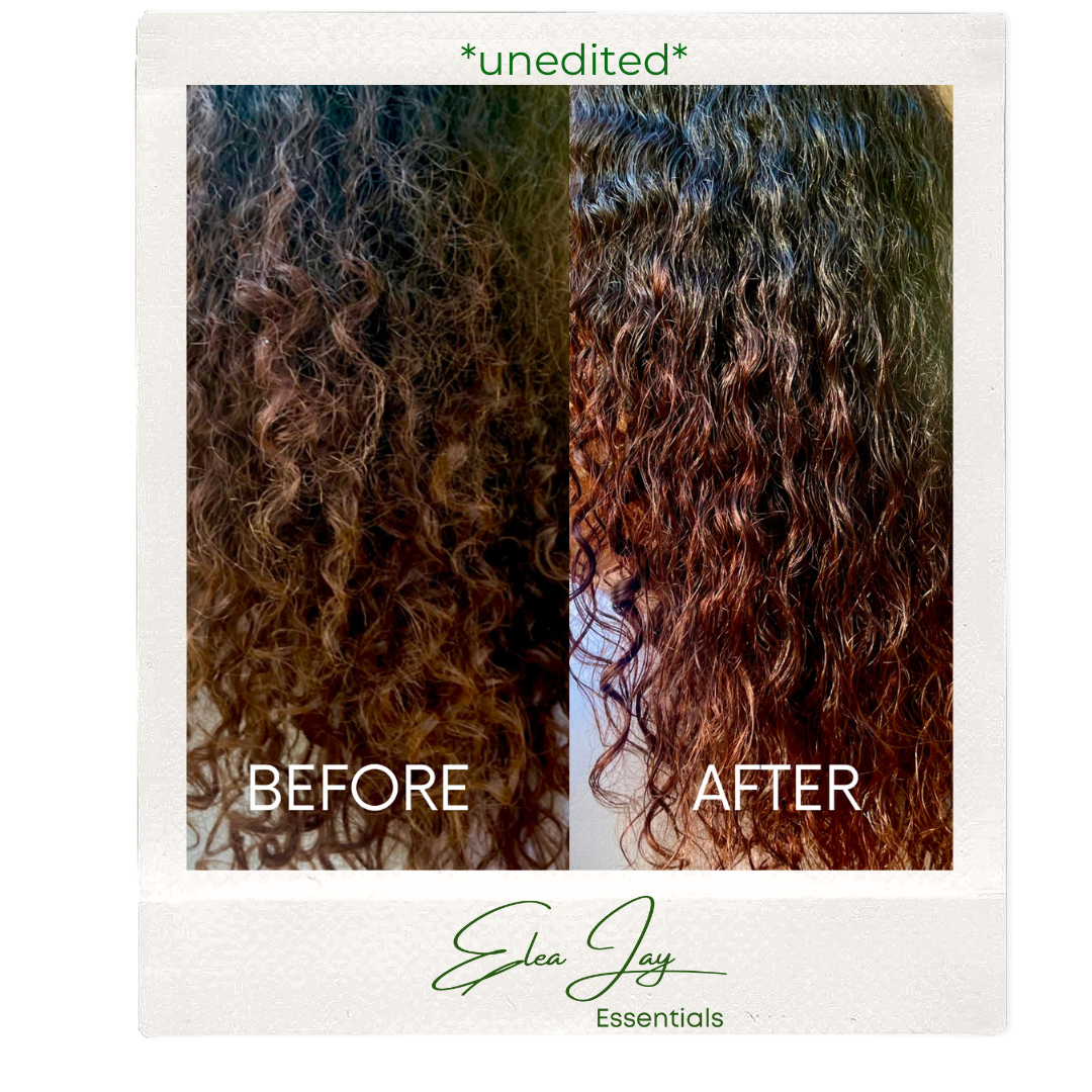 The HydraLoc Scalp Care System-Complete Collection