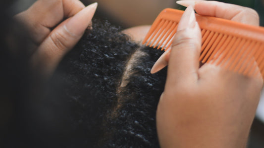 How to Heal a Dry, Itchy Scalp: Finding the right solution