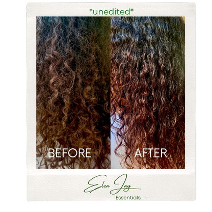 The HydraLoc Scalp Care System-Complete Collection
